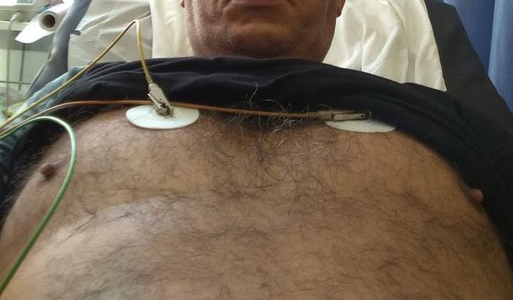 Λίγο έλειψε να χάσει την ζωή του υπάλληλος του Α.Τ Γαβαλούς από τσίμπημα σφήκας!