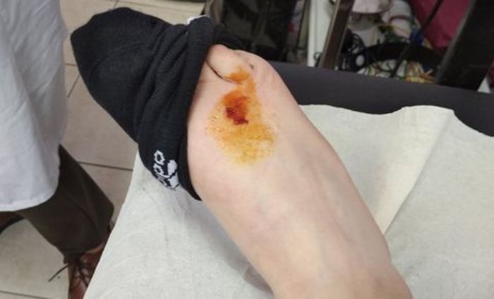 Αγρίνιο: Άνδρας δέχθηκε επίθεση από σκύλο(φωτο)