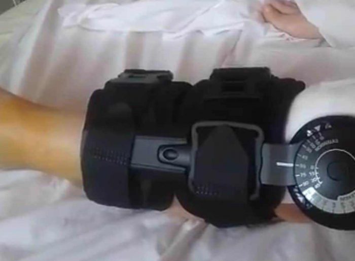 Αγρινιώτισσα τραυματίστηκε σοβαρά από ποδήλατο! (βιντεο)