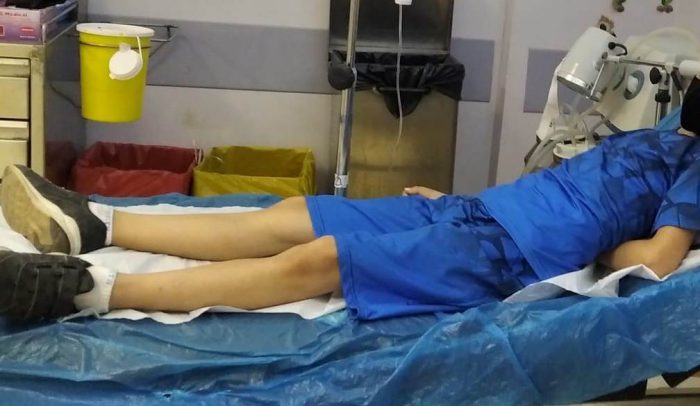 Στο Νοσοκομείο Πατρών ο 10χρονος από την Αμφιλοχία που τον τσίμπησε φίδι (φωτο)