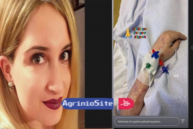Επίθεση με βιτριόλι: Η φωτογραφία που ανέβασε η Ιωάννα μετά το χειρουργείο