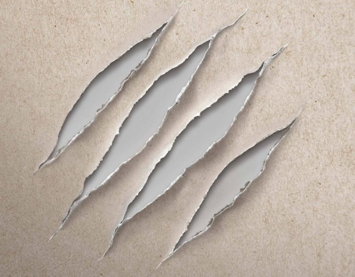 Δυσκολίες πρόσβασης σε νέες θεραπείες για ασθενείς με ατοπική δερματίτιδα