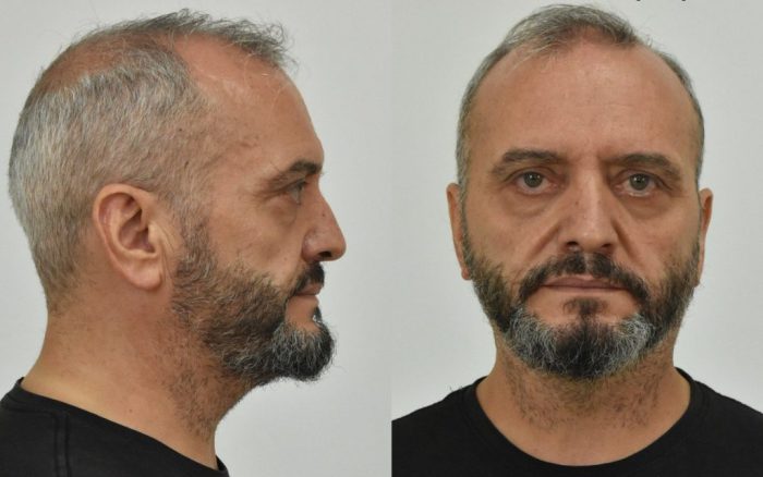 Αυτός είναι ο Αγρινιώτης που βίαζε και εξέδιδε το 12χρονο παιδί