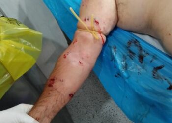 Αδέσποτα σκυλιά τραυμάτισαν σοβαρά 74χρονο στο Μεσολόγγι