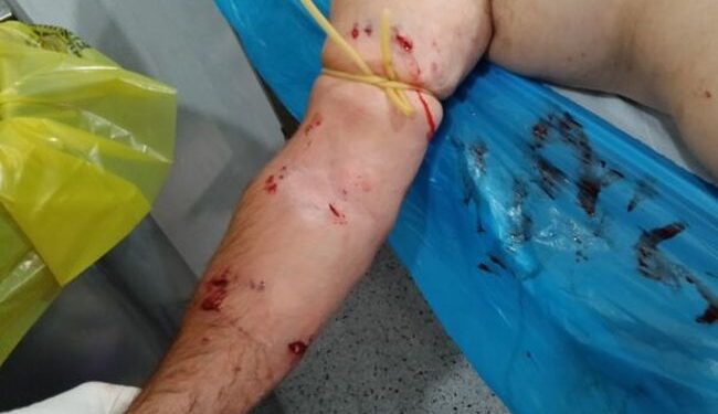 Αδέσποτα σκυλιά τραυμάτισαν σοβαρά 74χρονο στο Μεσολόγγι