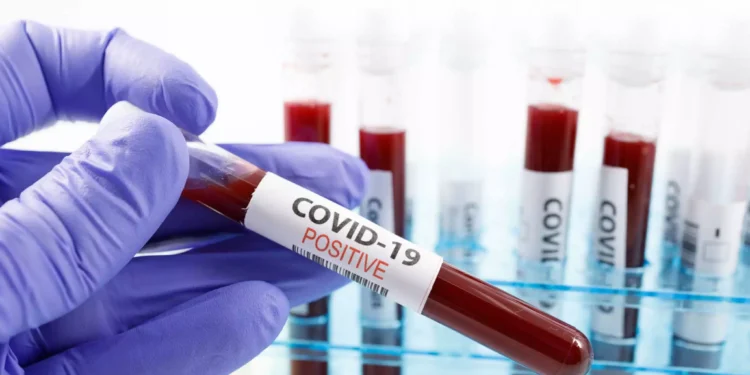 Κορονοϊός: Εξέταση αίματος εντοπίζει με ακρίβεια τους ασθενείς με long covid