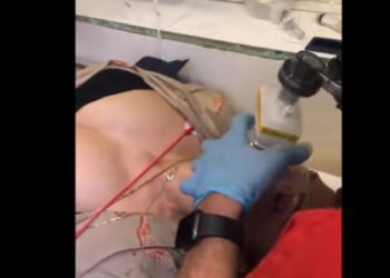 Θεσσαλονίκη: Τα κρίσιμα δευτερόλεπτα που έσωσαν 39χρονη μετά από δάγκωμα οχιάς – Συγκλονιστικό βίντεο