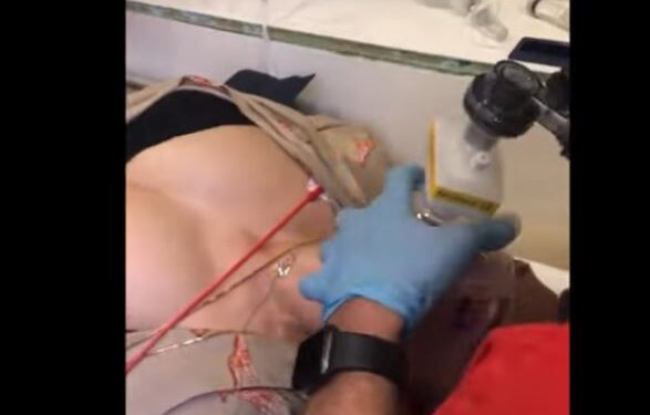 Θεσσαλονίκη: Τα κρίσιμα δευτερόλεπτα που έσωσαν 39χρονη μετά από δάγκωμα οχιάς – Συγκλονιστικό βίντεο