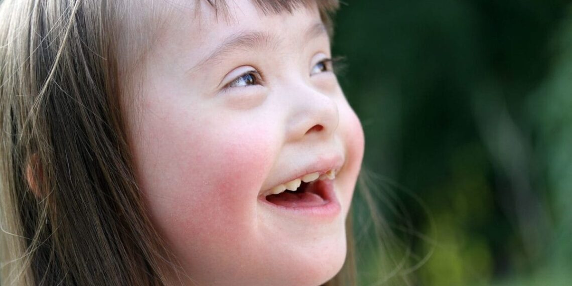 Ο Ιατρικός Σύλλογος Αγρινίου για την Παγκόσμια Ημέρα Συνδρόμου Down