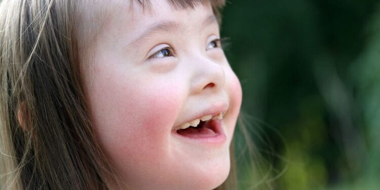 Ο Ιατρικός Σύλλογος Αγρινίου για την Παγκόσμια Ημέρα Συνδρόμου Down