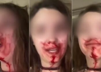 Ενδοοικογενειακή βία: Γυναίκα κατήγγειλε με αίματα στο πρόσωπο τον ξυλοδαρμό από τον σύζυγό της