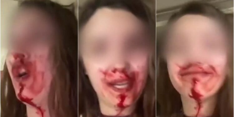 Ενδοοικογενειακή βία: Γυναίκα κατήγγειλε με αίματα στο πρόσωπο τον ξυλοδαρμό από τον σύζυγό της