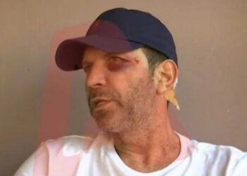 Αγρίνιο: Άγριος ξυλοδαρμός εστιάτορα από πελάτες επειδή δεν τους άρεσε το φαγητό