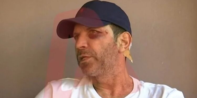 Αγρίνιο: Άγριος ξυλοδαρμός εστιάτορα από πελάτες επειδή δεν τους άρεσε το φαγητό