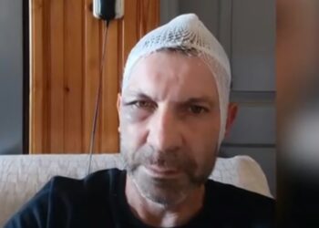 Παναιτώλιο Αγρινίου| οι δράστες του ξυλοδαρμού παραμένουν ασύλληπτοι-δέχομαι απειλές για την ζωή μου, λέει ο άτυχος άνδρας!