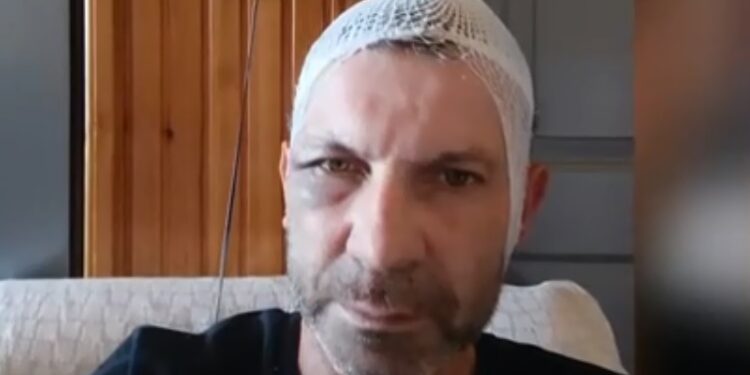 Παναιτώλιο Αγρινίου| οι δράστες του ξυλοδαρμού παραμένουν ασύλληπτοι-δέχομαι απειλές για την ζωή μου, λέει ο άτυχος άνδρας!