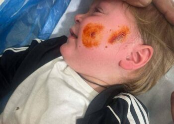 Αιτωλικό: Οργή για τον τραυματισμό παιδιών από αδέσποτο