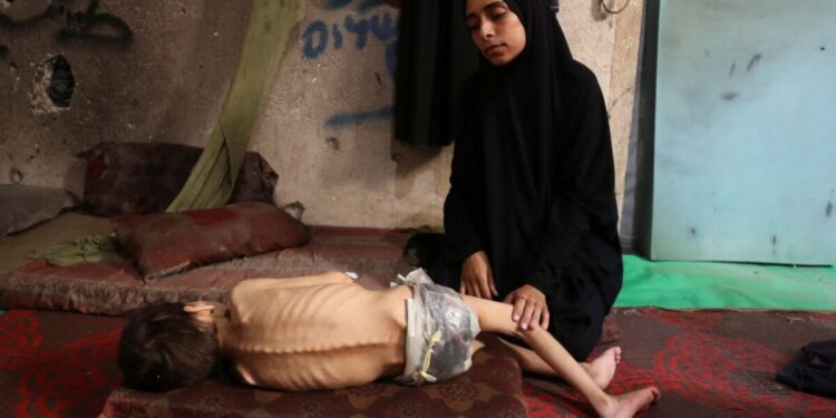 Tα υποσιτισμένα παιδιά στη Γάζα τριπλασιάστηκαν από τον Μάρτιο