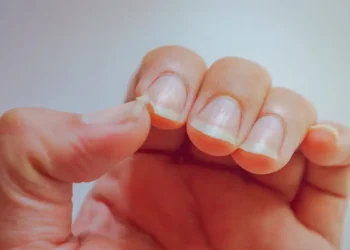 Τα 5+1 τρόφιμα για να έχετε δυνατά και υγιή νύχια – Τι προτείνουν οι ειδικοί