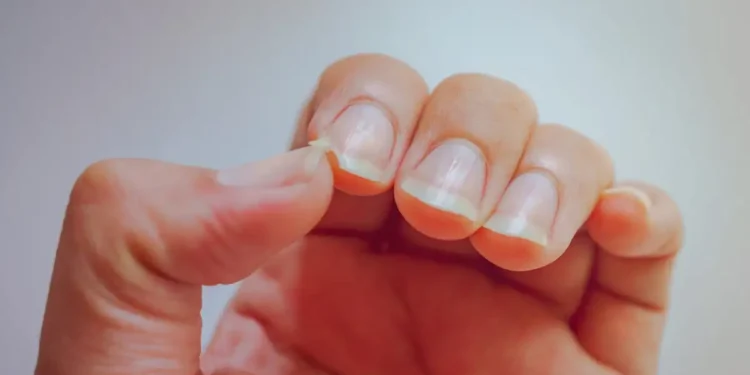 Τα 5+1 τρόφιμα για να έχετε δυνατά και υγιή νύχια – Τι προτείνουν οι ειδικοί