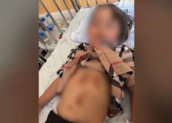 Επίθεση λύκου σε 5χρονο κορίτσι στη Χαλκιδική – Βίντεο και εικόνες από τα τραύματα