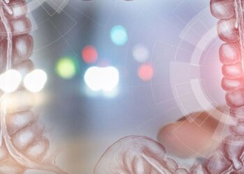 Εκκολπωμάτωση παχέος εντέρου: Παράγοντες κινδύνου και θεραπεία