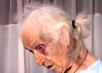 Αγγελόκαστρο: Ξυλοκόπησαν άγρια ηλικιωμένη για 100 ευρώ – Οργή για την άνανδρη επίθεση – «Τους παρακαλούσα, μη με χτυπάτε άλλο» (ΒΙΝΤΕΟ)