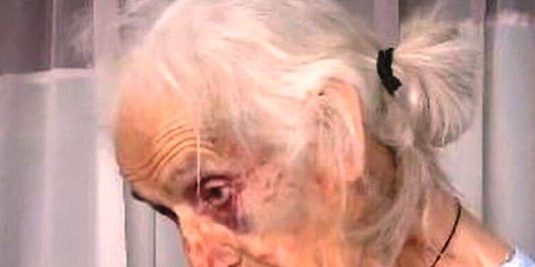 Αγγελόκαστρο: Ξυλοκόπησαν άγρια ηλικιωμένη για 100 ευρώ – Οργή για την άνανδρη επίθεση – «Τους παρακαλούσα, μη με χτυπάτε άλλο» (ΒΙΝΤΕΟ)