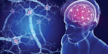 Σκλήρυνση κατά πλάκας: Δύο παράγοντες ευθύνονται για την ανάπτυξή της