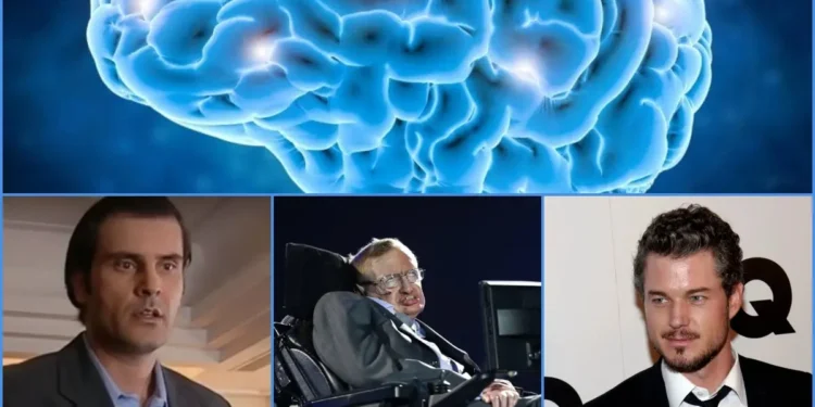 ALS: Η νευροεκφυλιστική ασθένεια που οδήγησε στον θάνατο πολλούς διάσημους – Όλα όσα πρέπει να γνωρίζουμε