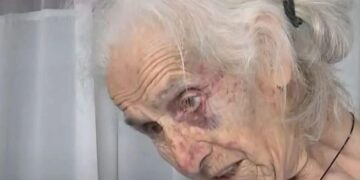 Άγρια ληστεία σε βάρος ηλικιωμένης στο Αγγελόκαστρο-Συνελήφθησαν δύο άνδρες